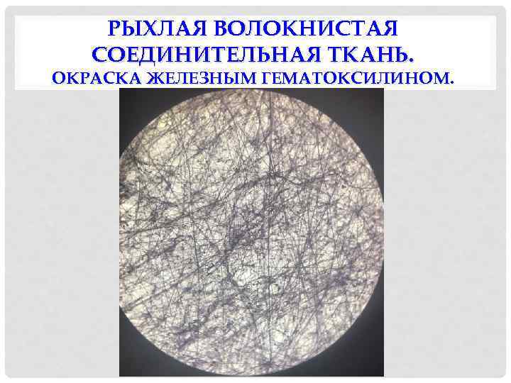 РЫХЛАЯ ВОЛОКНИСТАЯ СОЕДИНИТЕЛЬНАЯ ТКАНЬ. ОКРАСКА ЖЕЛЕЗНЫМ ГЕМАТОКСИЛИНОМ. 