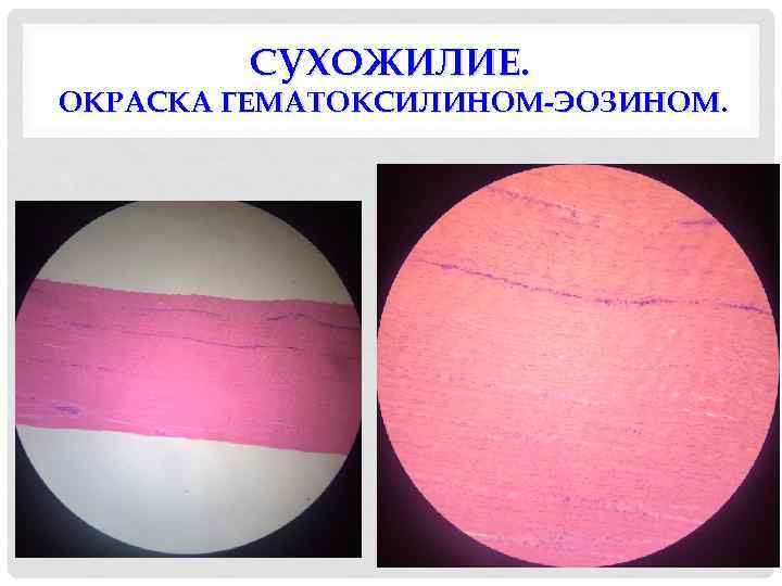 СУХОЖИЛИЕ. ОКРАСКА ГЕМАТОКСИЛИНОМ-ЭОЗИНОМ. 