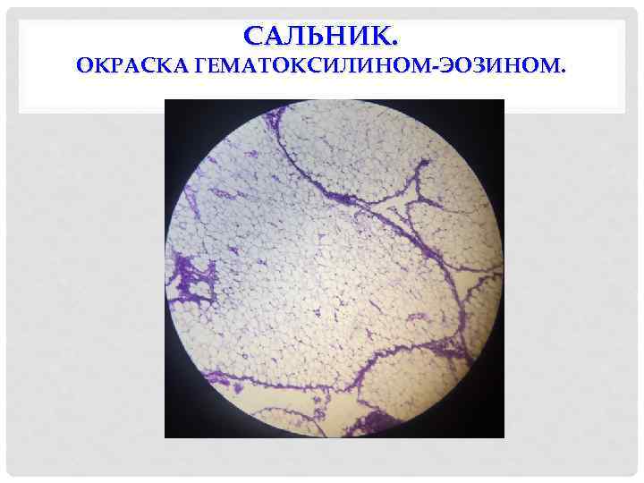 САЛЬНИК. ОКРАСКА ГЕМАТОКСИЛИНОМ-ЭОЗИНОМ. 