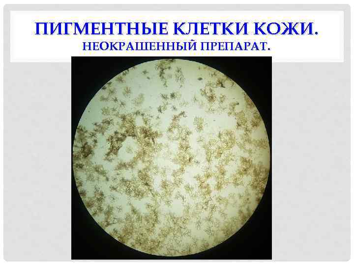 ПИГМЕНТНЫЕ КЛЕТКИ КОЖИ. НЕОКРАШЕННЫЙ ПРЕПАРАТ. 