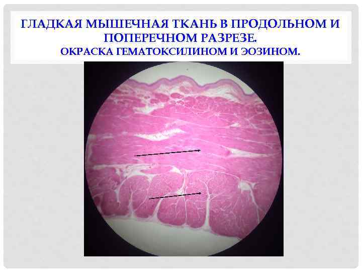 ГЛАДКАЯ МЫШЕЧНАЯ ТКАНЬ В ПРОДОЛЬНОМ И ПОПЕРЕЧНОМ РАЗРЕЗЕ. ОКРАСКА ГЕМАТОКСИЛИНОМ И ЭОЗИНОМ. 
