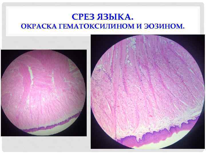 СРЕЗ ЯЗЫКА. ОКРАСКА ГЕМАТОКСИЛИНОМ И ЭОЗИНОМ. 