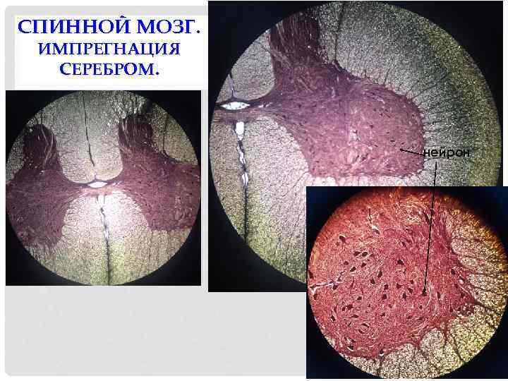 СПИННОЙ МОЗГ. ИМПРЕГНАЦИЯ СЕРЕБРОМ. нейрон 