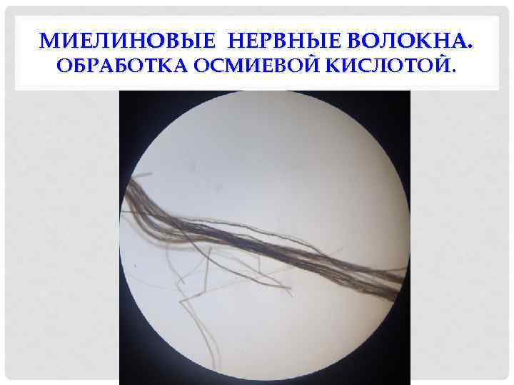 МИЕЛИНОВЫЕ НЕРВНЫЕ ВОЛОКНА. ОБРАБОТКА ОСМИЕВОЙ КИСЛОТОЙ. 