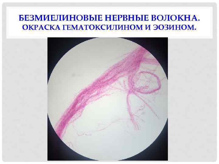 БЕЗМИЕЛИНОВЫЕ НЕРВНЫЕ ВОЛОКНА. ОКРАСКА ГЕМАТОКСИЛИНОМ И ЭОЗИНОМ. 