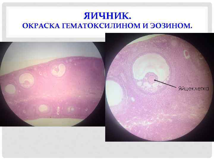 ЯИЧНИК. ОКРАСКА ГЕМАТОКСИЛИНОМ И ЭОЗИНОМ. Яйцеклетка 