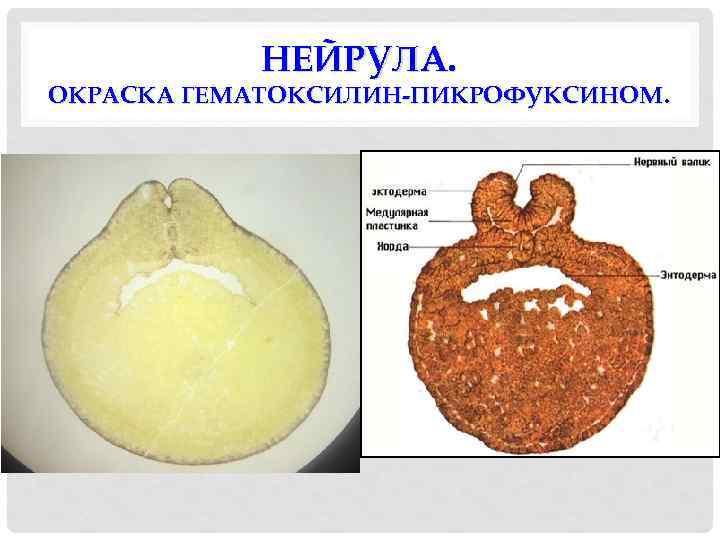 НЕЙРУЛА. ОКРАСКА ГЕМАТОКСИЛИН-ПИКРОФУКСИНОМ. 