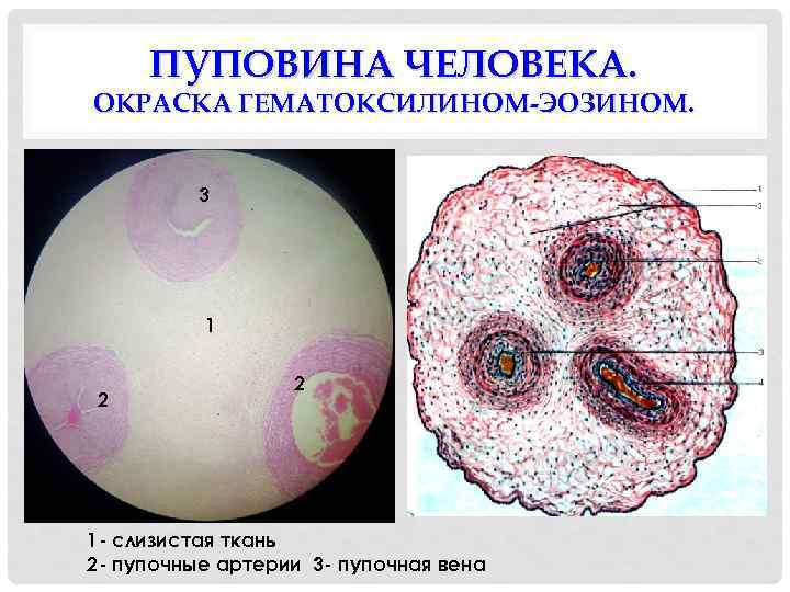 ПУПОВИНА ЧЕЛОВЕКА. ОКРАСКА ГЕМАТОКСИЛИНОМ-ЭОЗИНОМ. 3 1 2 2 1 - слизистая ткань 2 -