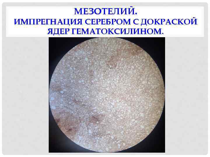 МЕЗОТЕЛИЙ. ИМПРЕГНАЦИЯ СЕРЕБРОМ С ДОКРАСКОЙ ЯДЕР ГЕМАТОКСИЛИНОМ. 