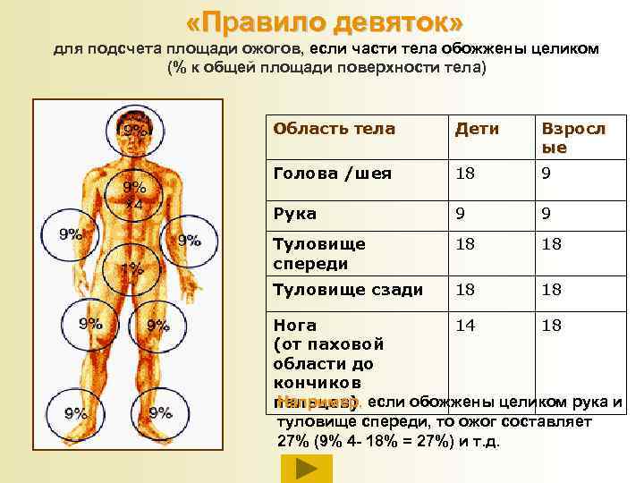  «Правило девяток» для подсчета площади ожогов, если части тела обожжены целиком (% к