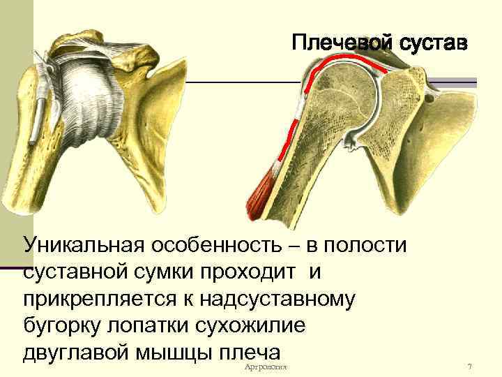 Плечевой сустав Уникальная особенность – в полости суставной cумки проходит и прикрепляется к надсуставному