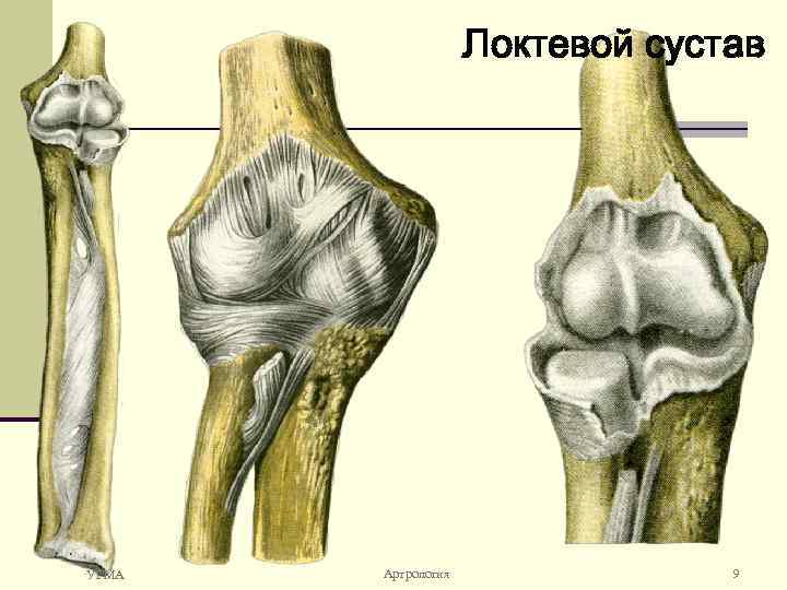 Локтевой сустав УГМА Артрология 9 