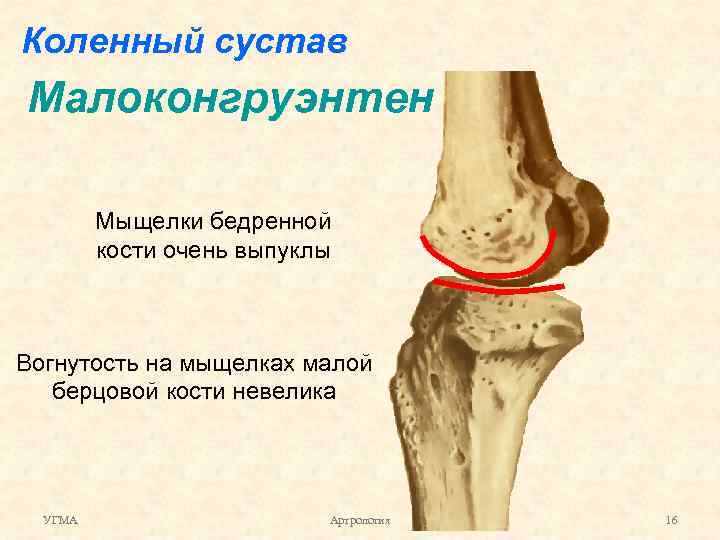 Наружный мыщелок большеберцовой кости фото