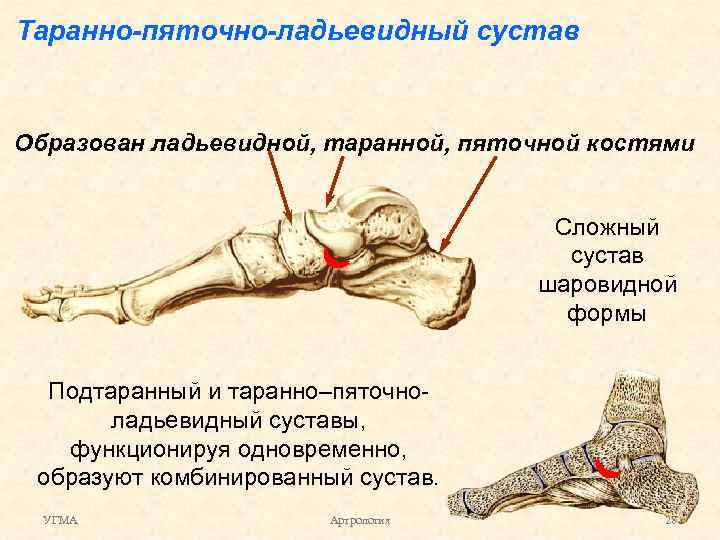 Добавочные кости стопы схема