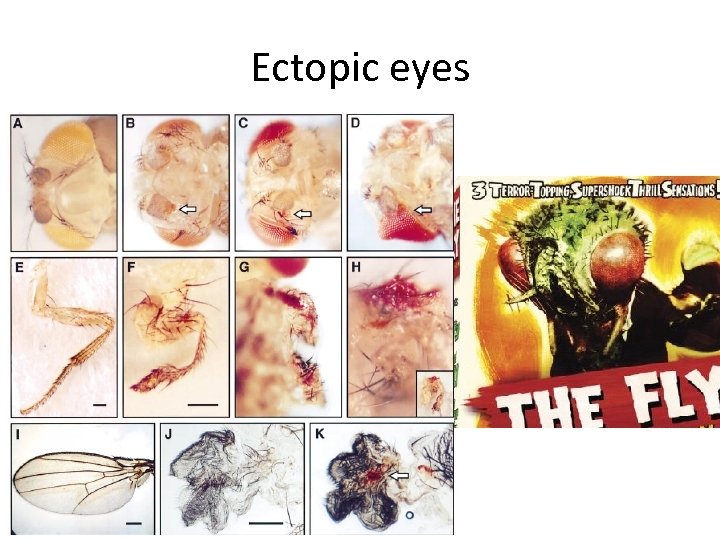 Ectopic eyes 
