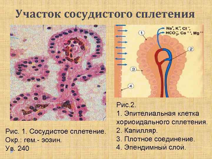 Участок сосудистого сплетения Рис. 1. Сосудистое сплетение. Окр. : гем. - эозин. Ув. 240