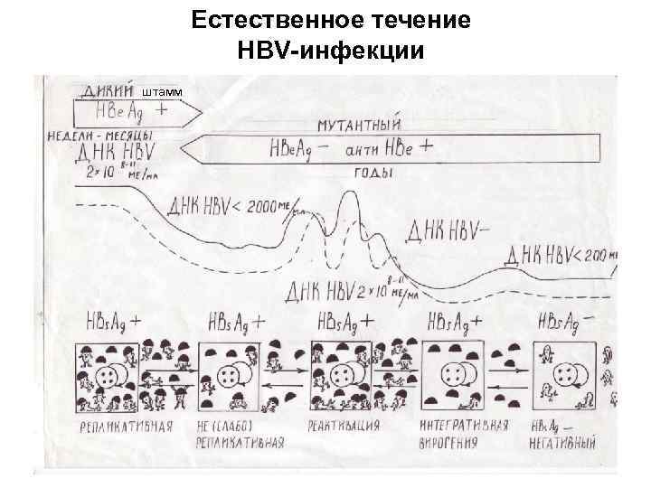 Естественное течение HBV-инфекции штамм 