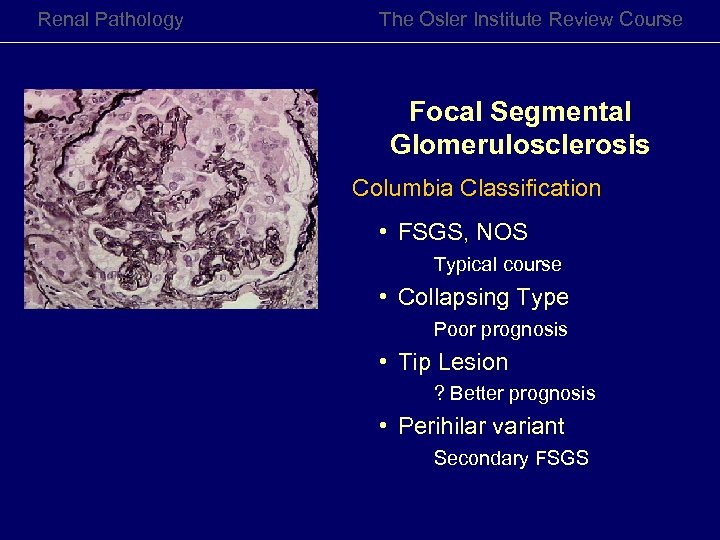 Renal Pathology The Osler Institute Review Course Focal Segmental Glomerulosclerosis Columbia Classification • FSGS,