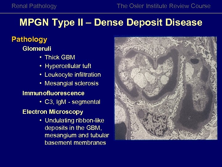 Renal Pathology Review Medical Diseases of the Kidney