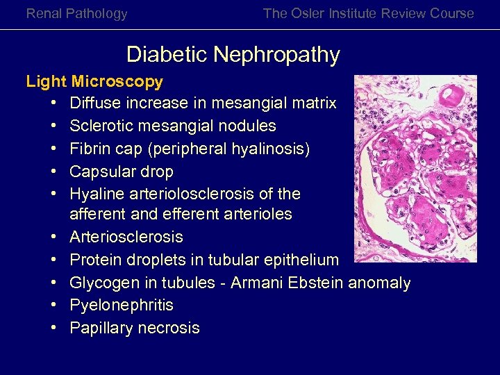 Renal Pathology The Osler Institute Review Course Diabetic Nephropathy Light Microscopy • Diffuse increase