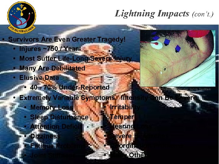 Lightning Impacts (con’t. ) • Survivors Are Even Greater Tragedy! • Injures ~750 /