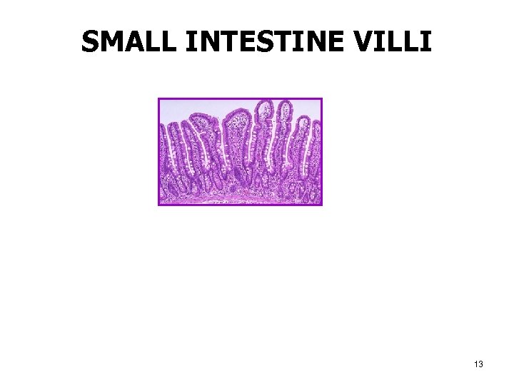 SMALL INTESTINE VILLI 13 