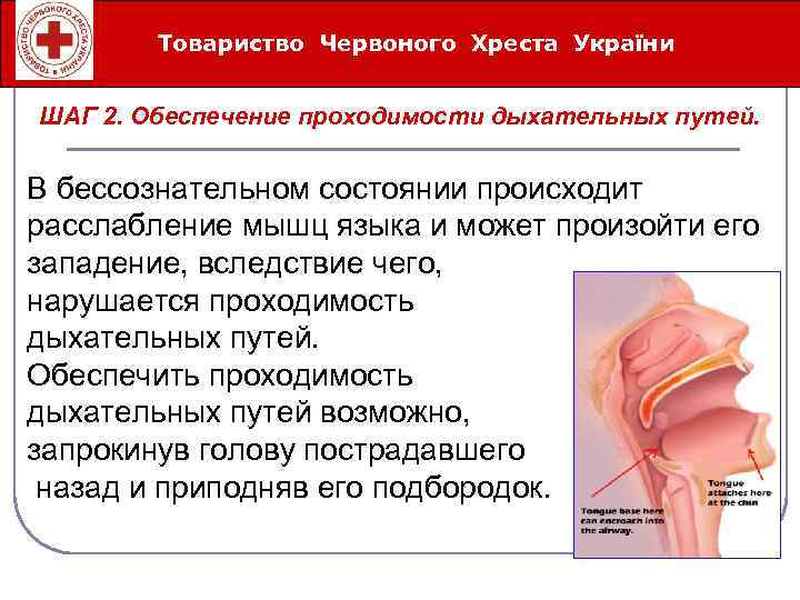 Товариство Червоного Хреста України Íåîòëîæíûå ñåðäå÷íî-ñîñóäèñòûå ñîñòîÿíèÿ ШАГ 2. Обеспечение проходимости дыхательных путей. В