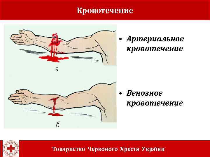 Learning objectives Кровотечение • Артериальное кровотечение • Венозное кровотечение Товариство Червоного Хреста України 
