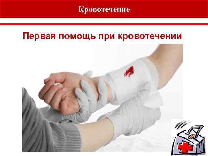 Кровотечение e. how to treat a big bleed Первая помощь при кровотечении 