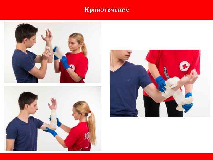 Кровотечение 