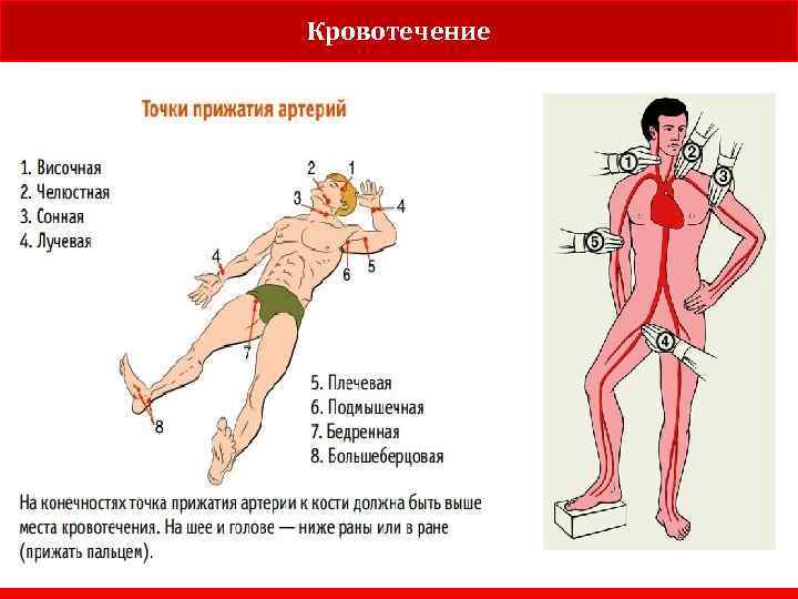 Кровотечение 