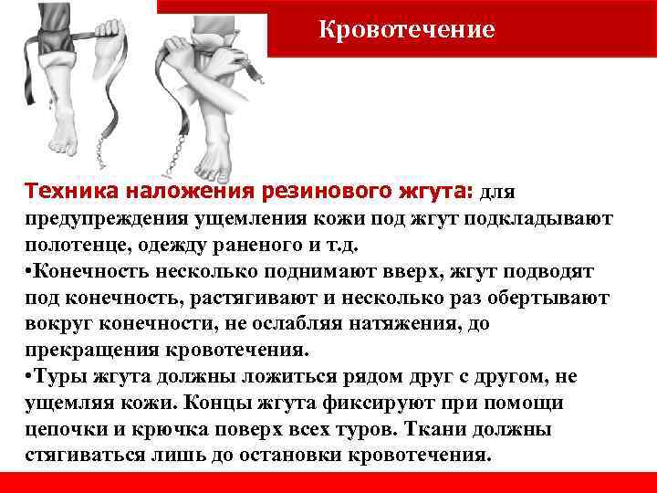 Кровотечение Learning objectives Техника наложения резинового жгута: для предупреждения ущемления кожи под жгут подкладывают
