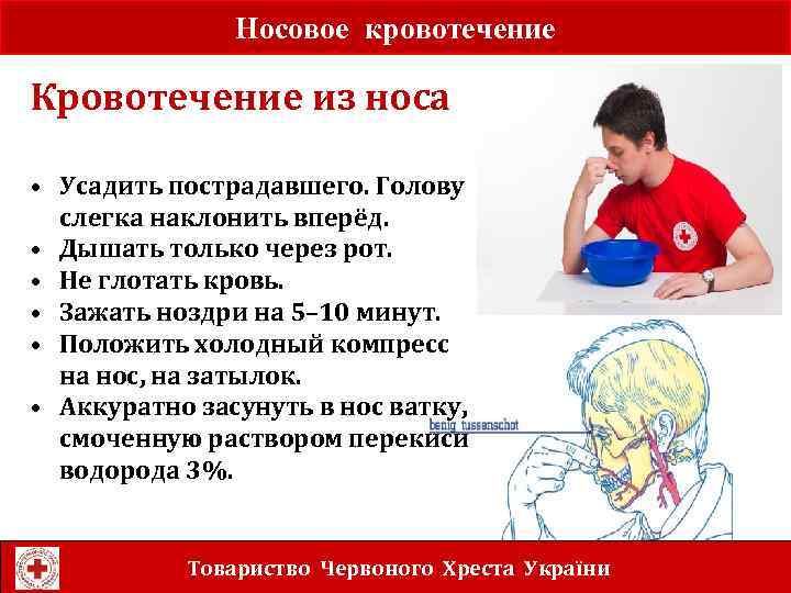 Носовое кровотечение Кровотечение из носа • Усадить пострадавшего. Голову слегка наклонить вперёд. • Дышать
