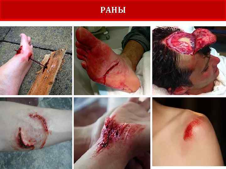 РАНЫ Learning objectives 