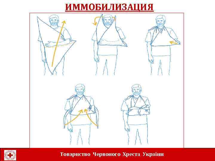 ИММОБИЛИЗАЦИЯ Товариство Червоного Хреста України 