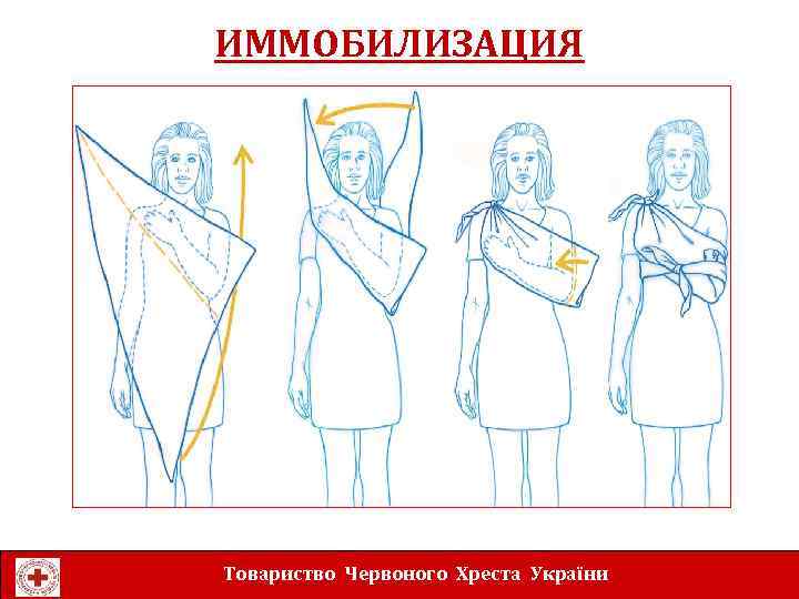 ИММОБИЛИЗАЦИЯ Товариство Червоного Хреста України 