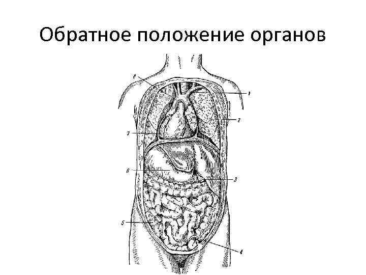 Обратное положение органов 