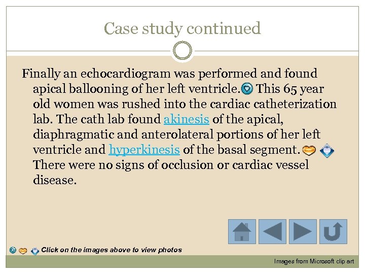 Case study continued Finally an echocardiogram was performed and found apical ballooning of her