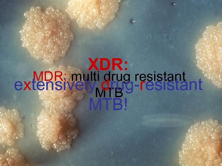 XDR: MDR: multi drug resistant extensively. MTB drug-resistant MTB! 