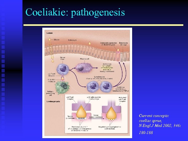 Coeliakie: pathogenesis Current concepts: coeliac sprue, N Engl J Med 2002, 346: 180 -188