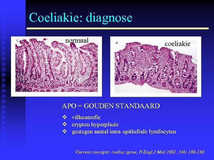 Coeliakie: diagnose normaal coeliakie APO = GOUDEN STANDAARD v villusatrofie v crypten hyperplasie v