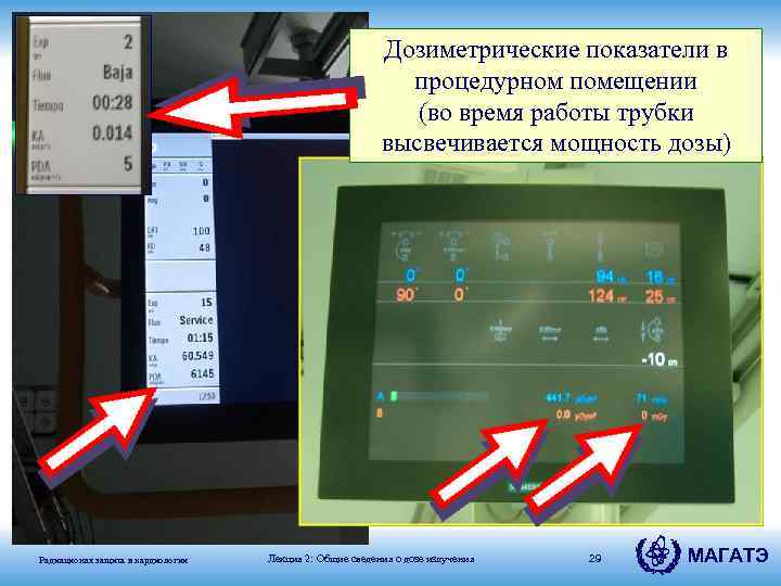 Дозиметрические показатели в процедурном помещении (во время работы трубки высвечивается мощность дозы) Радиационая защита