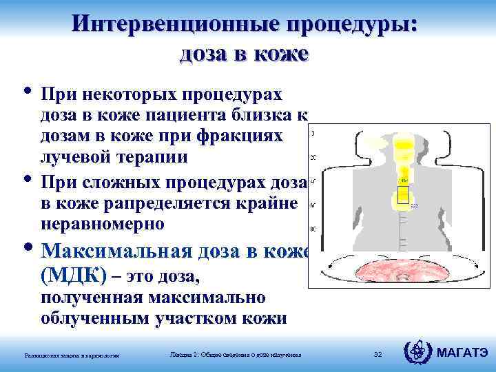 Интервенционные процедуры: доза в коже • При некоторых процедурах • доза в коже пациента