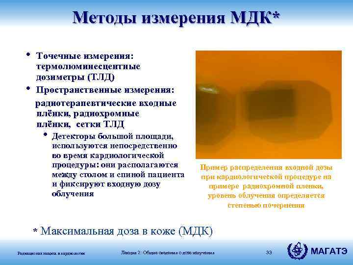 Методы измерения МДК* • Точечные измерения: термолюминесцентные дозиметры (ТЛД) • Пространственные измерения: радиотерапевтические входные