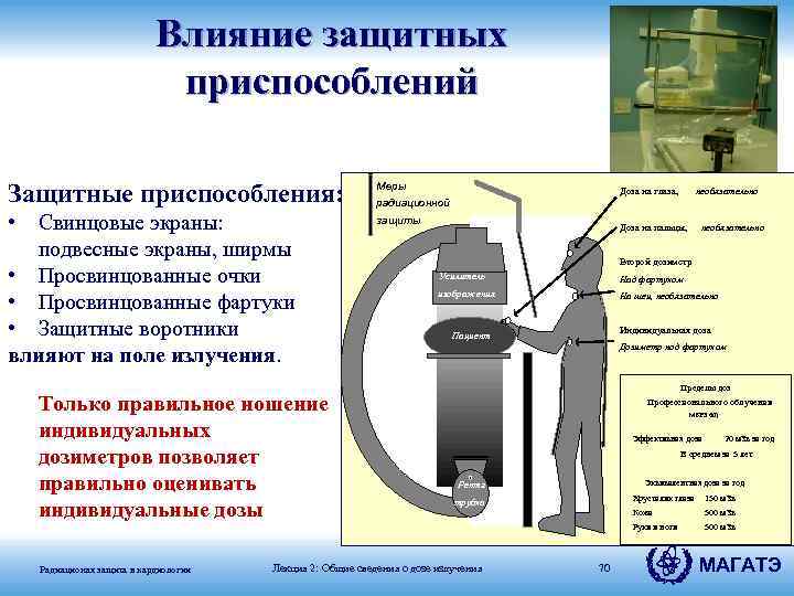 Влияние защитных приспособлений Защитные приспособления: Меры • Свинцовые экраны: подвесные экраны, ширмы • Просвинцованные