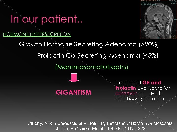 In our patient. . HORMONE HYPERSECRETION Growth Hormone Secreting Adenoma (>90%) Prolactin Co-Secreting Adenoma