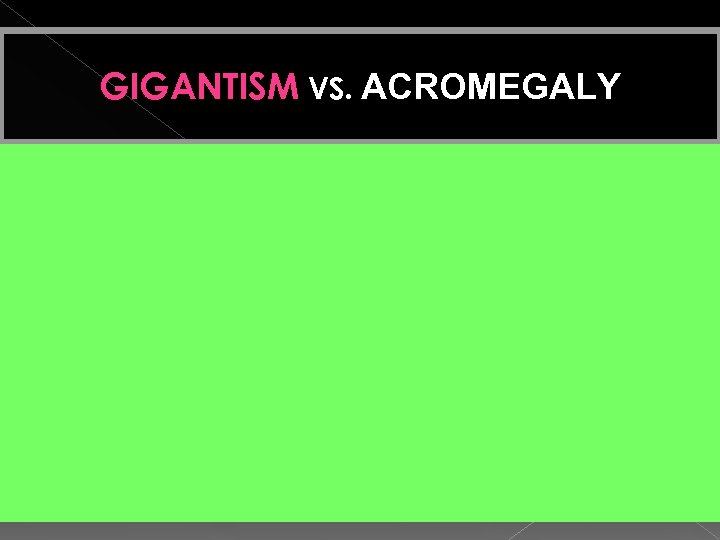 GIGANTISM VS. ACROMEGALY TIMING OF GH EXCESS During period of active growth Open epiphyseal