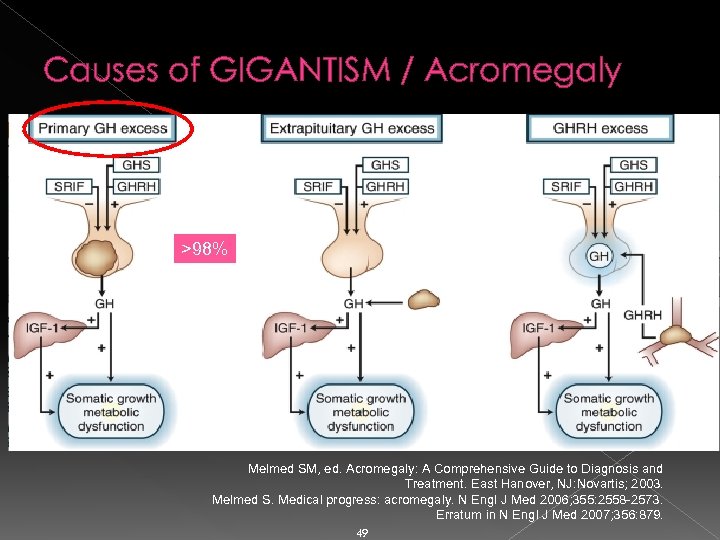 Causes of GIGANTISM / Acromegaly >98% Melmed SM, ed. Acromegaly: A Comprehensive Guide to