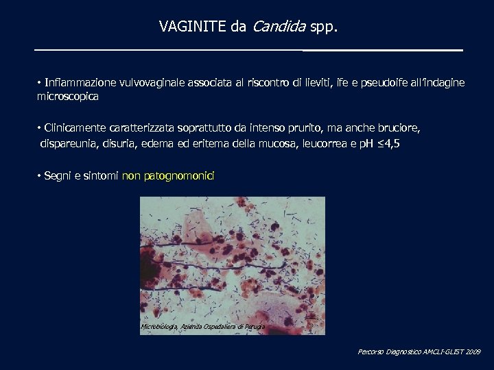 VAGINITE da Candida spp. • Infiammazione vulvovaginale associata al riscontro di lieviti, ife e