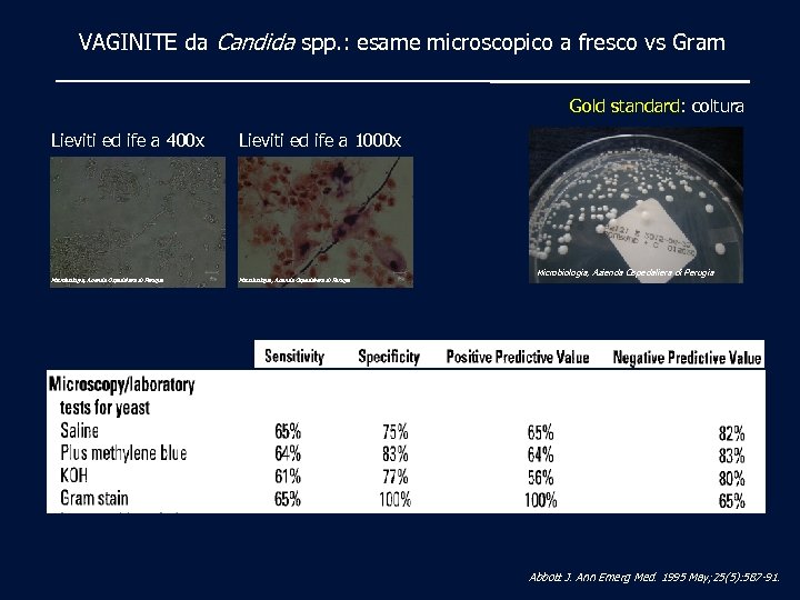 VAGINITE da Candida spp. : esame microscopico a fresco vs Gram Gold standard: coltura